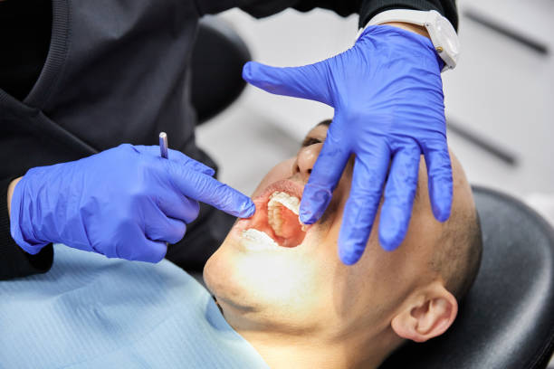 Best Knocked-Out Tooth Emergency  in Wauseon, OH